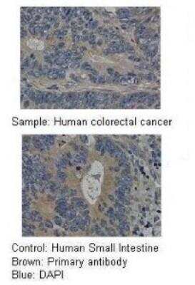 Immunohistochemistry-Paraffin: MMP-19 Antibody [NBP1-57094]