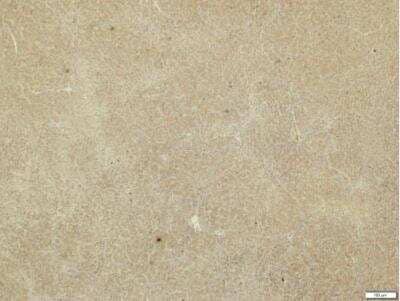 Immunohistochemistry-Paraffin: MMP-19 Antibody [NBP2-17311]