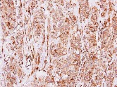 Immunohistochemistry-Paraffin: MMP-19 Antibody [NBP2-17312]