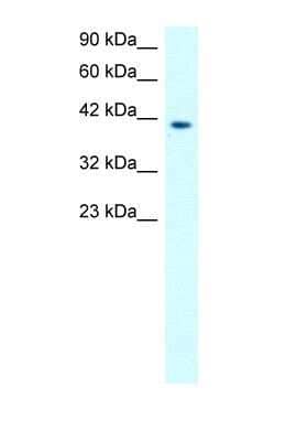 Western Blot: MMP-19 Antibody [NBP1-57092]