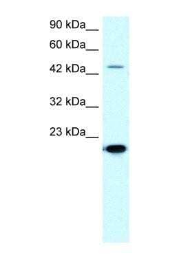 Western Blot: MMP-19 Antibody [NBP1-57094]