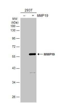 Western Blot: MMP-19 Antibody [NBP2-17311]