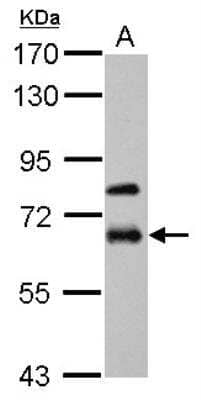 Western Blot: MMP-19 Antibody [NBP2-17312]