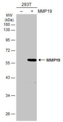 Western Blot: MMP-19 Antibody [NBP2-17312]