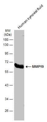 Western Blot: MMP-19 Antibody [NBP2-17312]