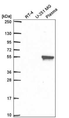 Western Blot: MMP-19 Antibody [NBP2-57845]