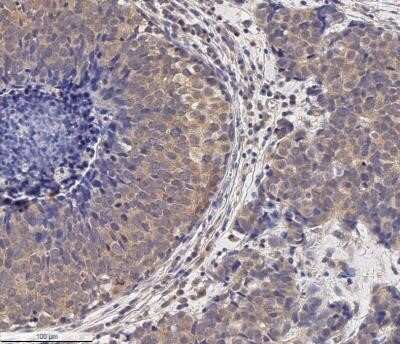 Immunohistochemistry: MMP-2 Antibody (2C1) - (Pro and Active) - Azide and BSA Free [NBP2-80853]