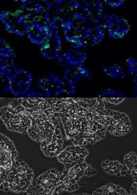 Immunohistochemistry: MMP-2 Antibody (2C1) - (Pro and Active) - Azide and BSA Free [NBP2-80853]