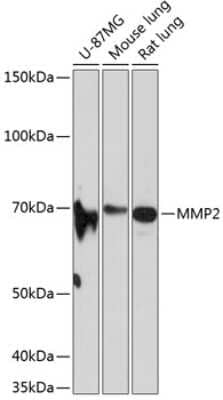 Western Blot: MMP-2 Antibody (3Q7R10) [NBP3-15653]