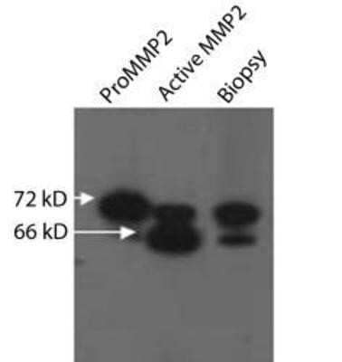 Western Blot: MMP-2 Antibody (8B4)(Pro and Active)Azide and BSA Free [NBP2-80854]