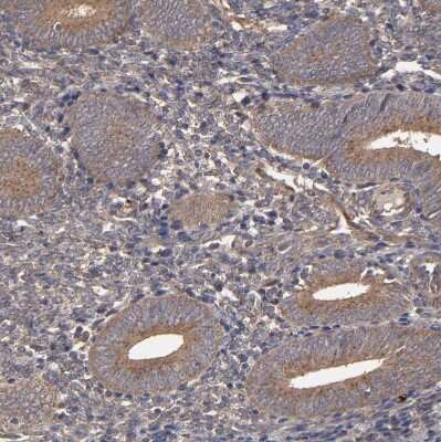 Immunohistochemistry-Paraffin: MMP-2 Antibody [NBP2-54667]