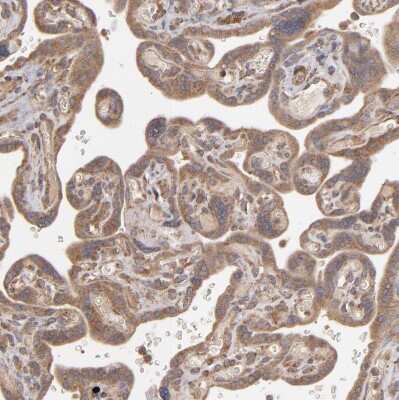 Immunohistochemistry-Paraffin: MMP-2 Antibody [NBP2-54667]