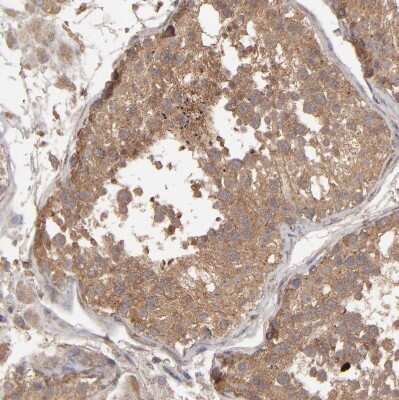 Immunohistochemistry-Paraffin: MMP-2 Antibody [NBP2-54667]
