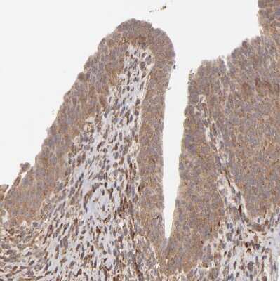 Immunohistochemistry-Paraffin: MMP-2 Antibody [NBP2-54667]