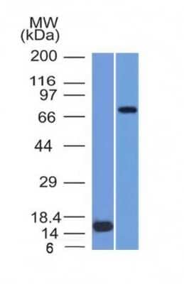 Western Blot: MMP-2 Antibody (MMP2/1501)Azide and BSA Free [NBP2-54364]