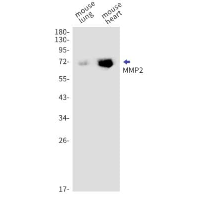 Western Blot: MMP-2 Antibody (S06-4H3) [NBP3-20080]