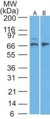 Western Blot: MMP-2 Antibody [NBP2-27208]