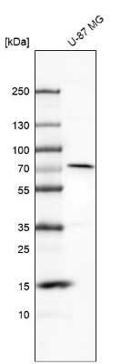 Western Blot: MMP-2 Antibody [NBP2-54667]