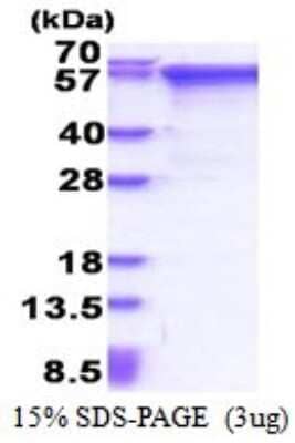 SDS-PAGE: Recombinant Human MMP-2 His Protein [NBP2-53037]