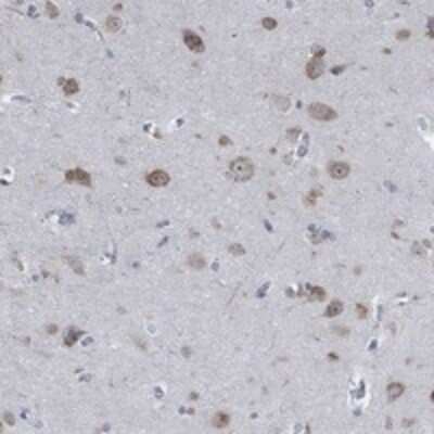 Immunohistochemistry-Paraffin: MMP-24/MT5-MMP Antibody [NBP3-17274]