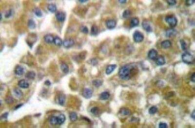 Immunohistochemistry-Paraffin: MMP-3 Antibody - BSA Free [NB100-91878]