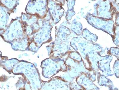 Immunohistochemistry-Paraffin: MMP-3 Antibody (MMP3/2806) [NBP3-07321]