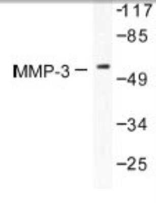 Western Blot: MMP-3 AntibodyBSA Free [NB100-91878]