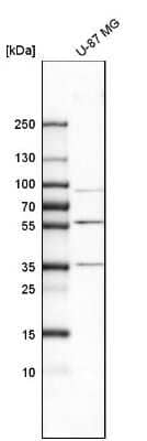 Western Blot: MMP-3 Antibody [NBP1-82431]