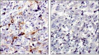 Immunohistochemistry: MMP-7 Antibody - BSA Free [NBP1-99123]