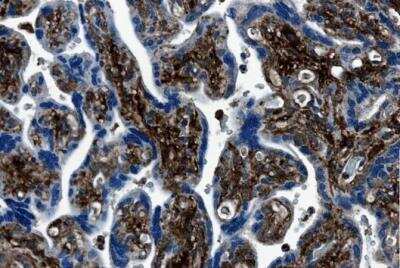 Immunohistochemistry-Paraffin: MMP-7 Antibody (MM0022-4C21) - Azide and BSA Free [NB110-60988]