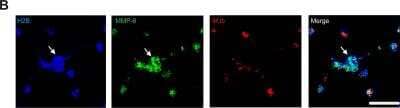 Immunocytochemistry/ Immunofluorescence: MMP-8 Antibody [NBP1-85576]