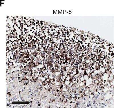 Immunohistochemistry-Paraffin: MMP-8 Antibody [NBP1-85576]