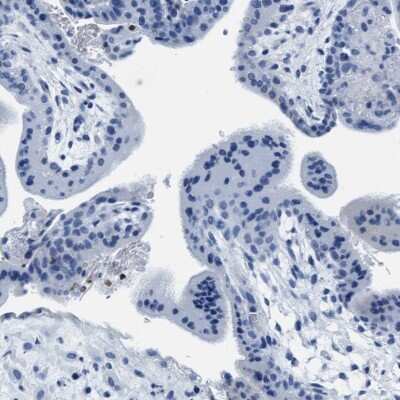 Immunohistochemistry-Paraffin: MMP-8 Antibody [NBP1-85577]