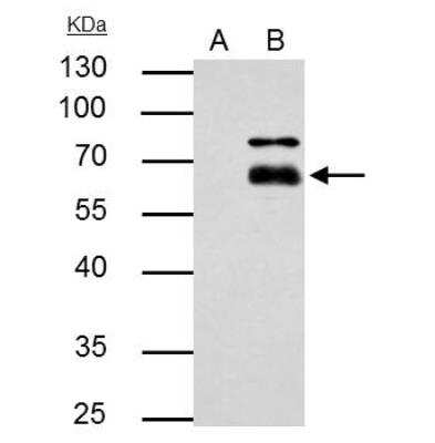 Immunoprecipitation: MMP-8 Antibody [NBP2-17316]