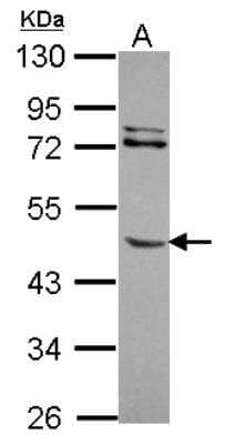 Western Blot: MMP-8 Antibody [NBP2-17317]