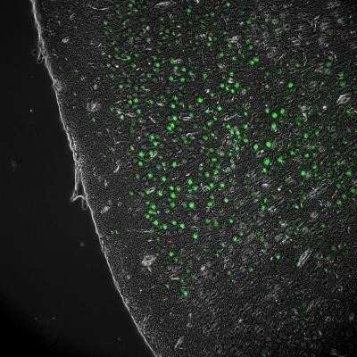 Immunohistochemistry: MMP-9 Antibody (4A3) - Azide and BSA Free [NBP2-80855]
