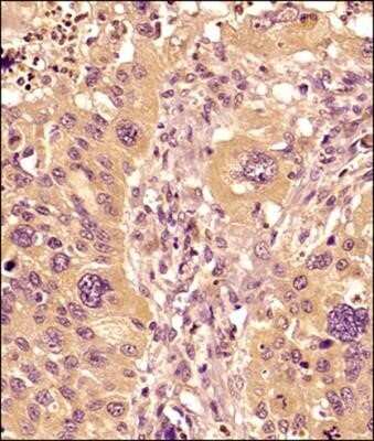 Immunohistochemistry-Paraffin: MMP-9 Antibody (4A3) - Azide and BSA Free [NBP2-80855]