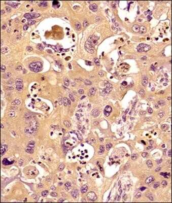 Immunohistochemistry-Paraffin: MMP-9 Antibody (4A3) - Azide and BSA Free [NBP2-80855]