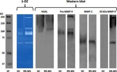 Western Blot: MMP-9 Antibody (4A3)Azide and BSA Free [NBP2-80855]