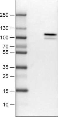 Western Blot: MMP-9 Antibody (CL0538) [NBP2-52948]