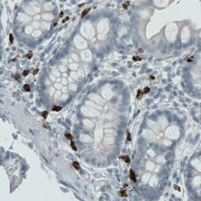 Immunohistochemistry: MMP-9 Antibody (CL0539) [NBP2-52949]