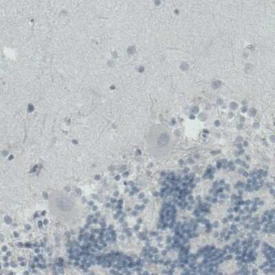 Immunohistochemistry-Paraffin: MMP-9 Antibody (CL0539) [NBP2-52949]
