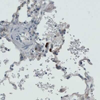 Immunohistochemistry-Paraffin: MMP-9 Antibody (CL0539) [NBP2-52949]