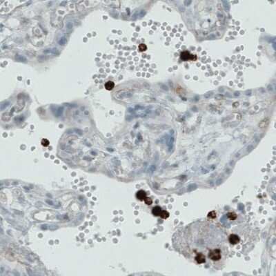 Immunohistochemistry-Paraffin: MMP-9 Antibody (CL0539) [NBP2-52949]