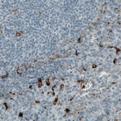 Immunohistochemistry-Paraffin: MMP-9 Antibody (CL0539) [NBP2-52949]