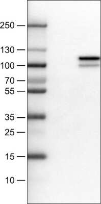 Western Blot: MMP-9 Antibody (CL0539) [NBP2-52949]