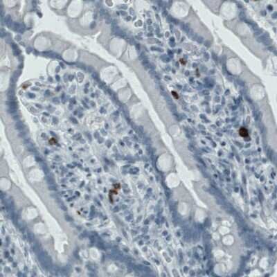 Immunohistochemistry: MMP-9 Antibody (CL0542) [NBP2-52950]