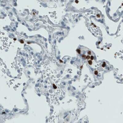 Immunohistochemistry-Paraffin: MMP-9 Antibody (CL0542) [NBP2-52950]