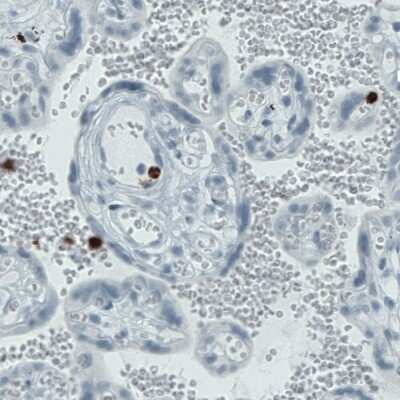 Immunohistochemistry-Paraffin: MMP-9 Antibody (CL0542) [NBP2-52950]