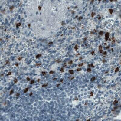 Immunohistochemistry-Paraffin: MMP-9 Antibody (CL0542) [NBP2-52950]